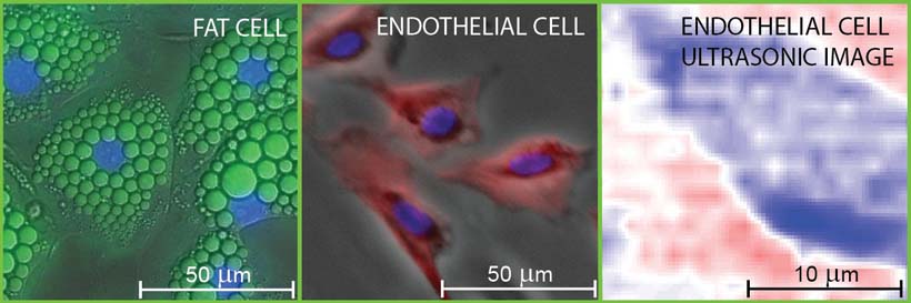 : Fluorescence micrographs of fat and endothelial cells superimposed on differential-interference and phase-contrast images, respectively. 