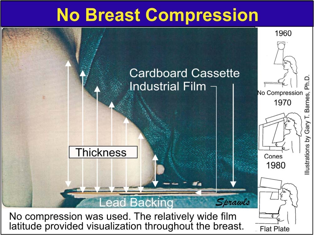 No Breast Compression